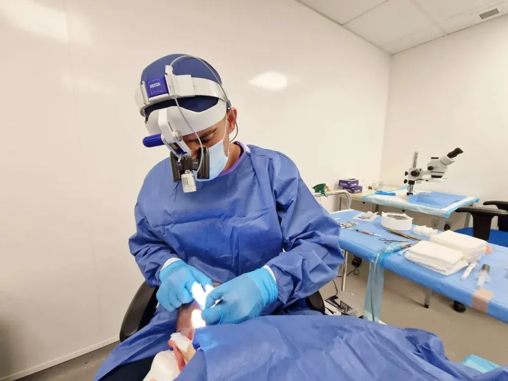 FUE hair transplant