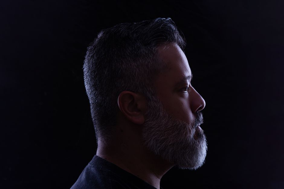 Beard Restoration