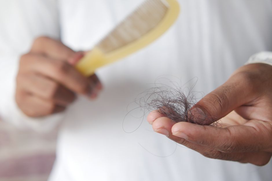 Crown Hair Transplant