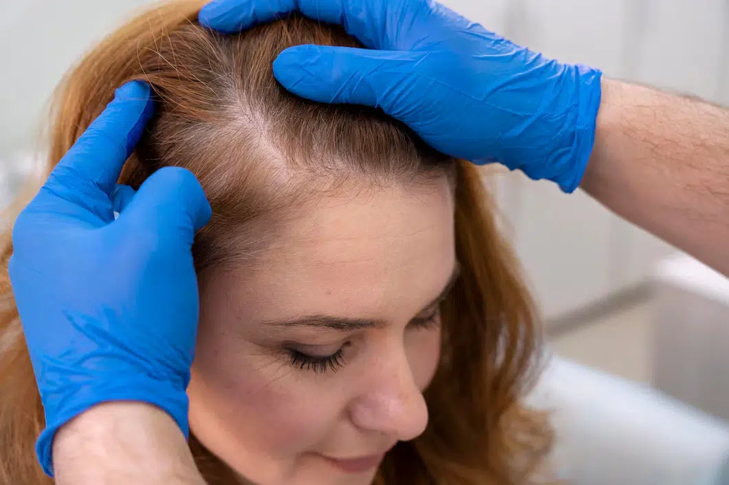 Am I a good candidate for a hair transplant?