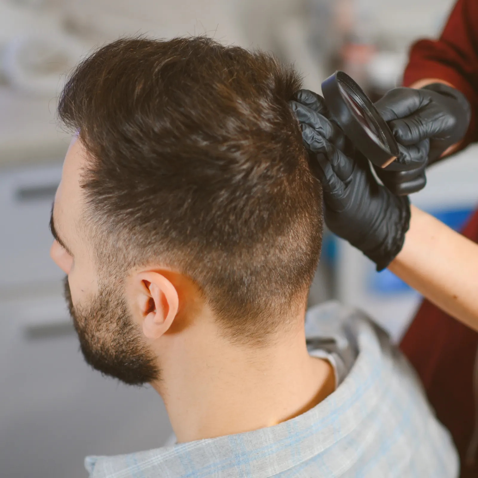 Assessment for hair transplant suitability