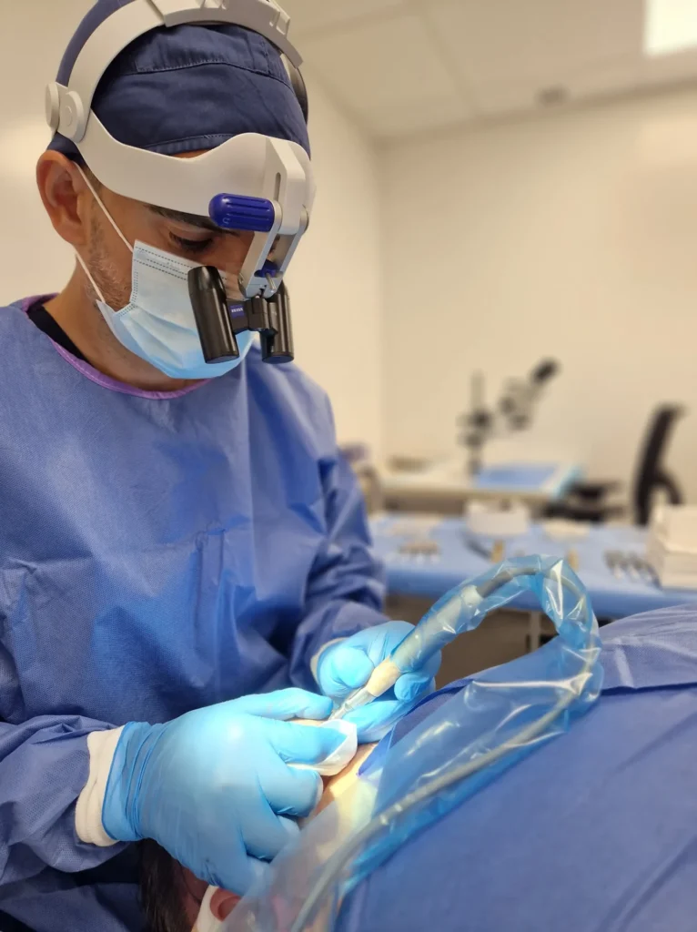 Hair restoration result at the Dr Bonaros clinic