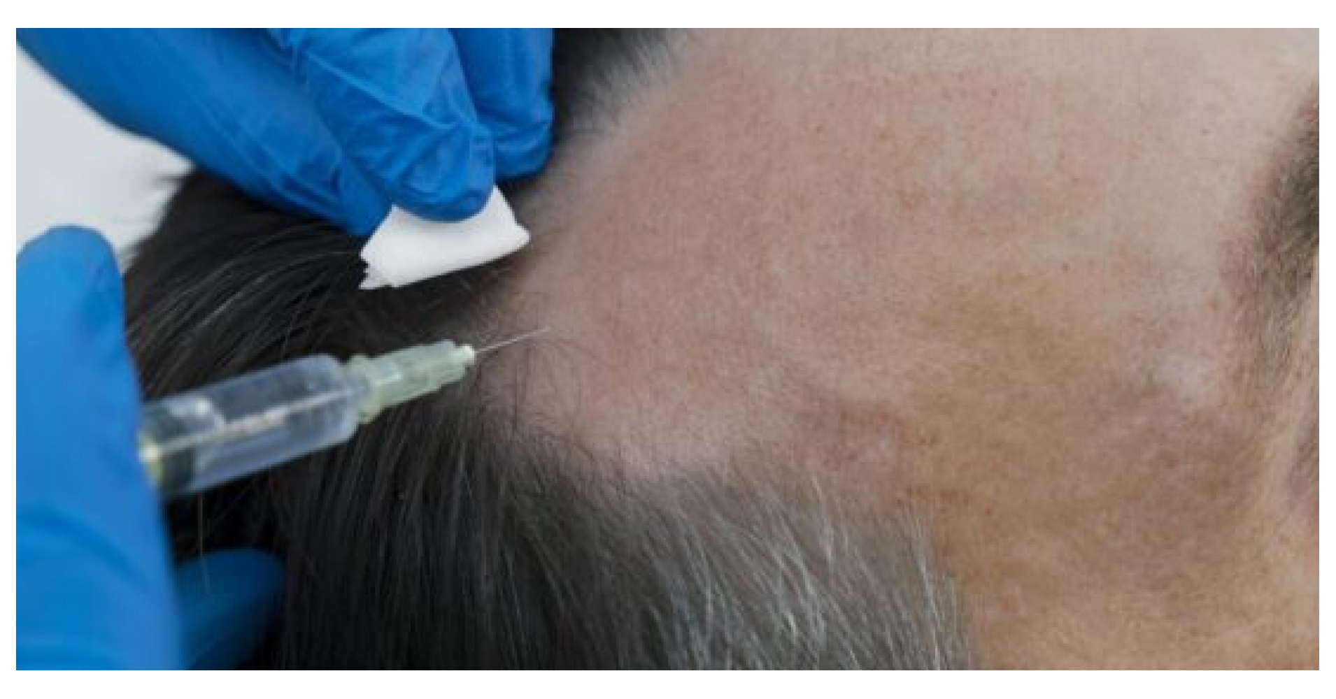 Non-Surgical<br>Hair Treatment