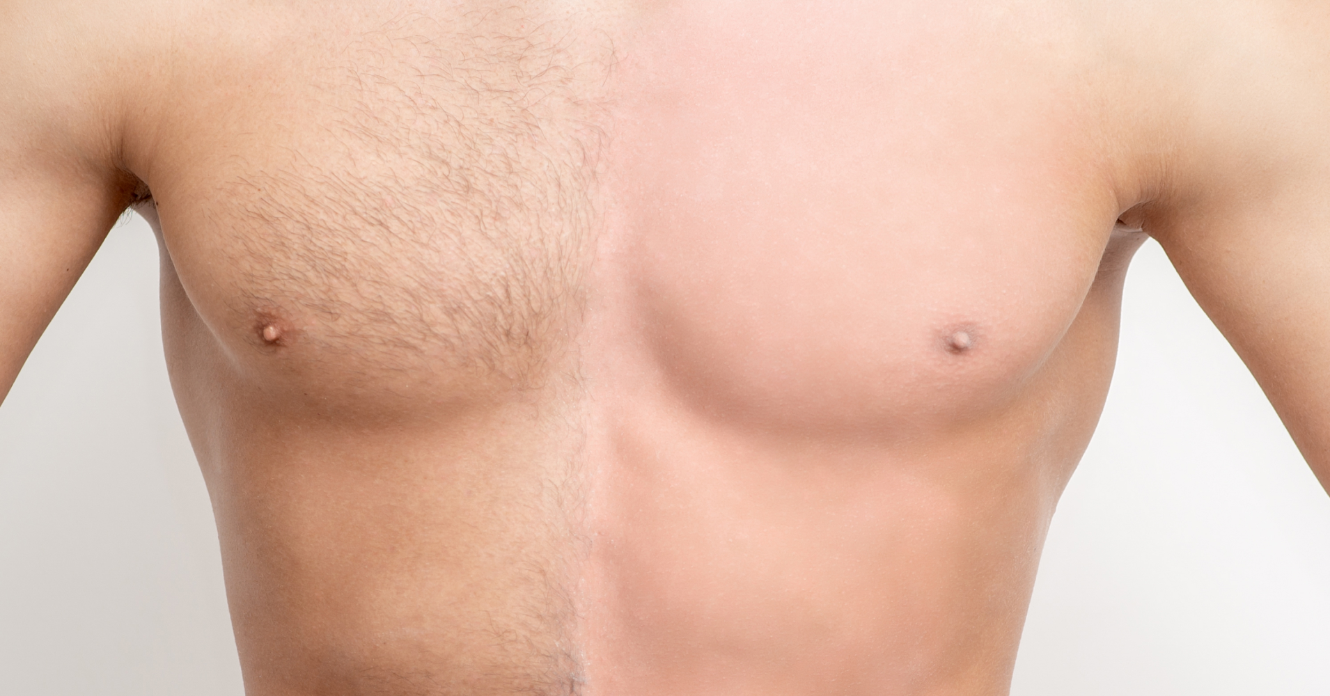 Body Hair<br>Transplant