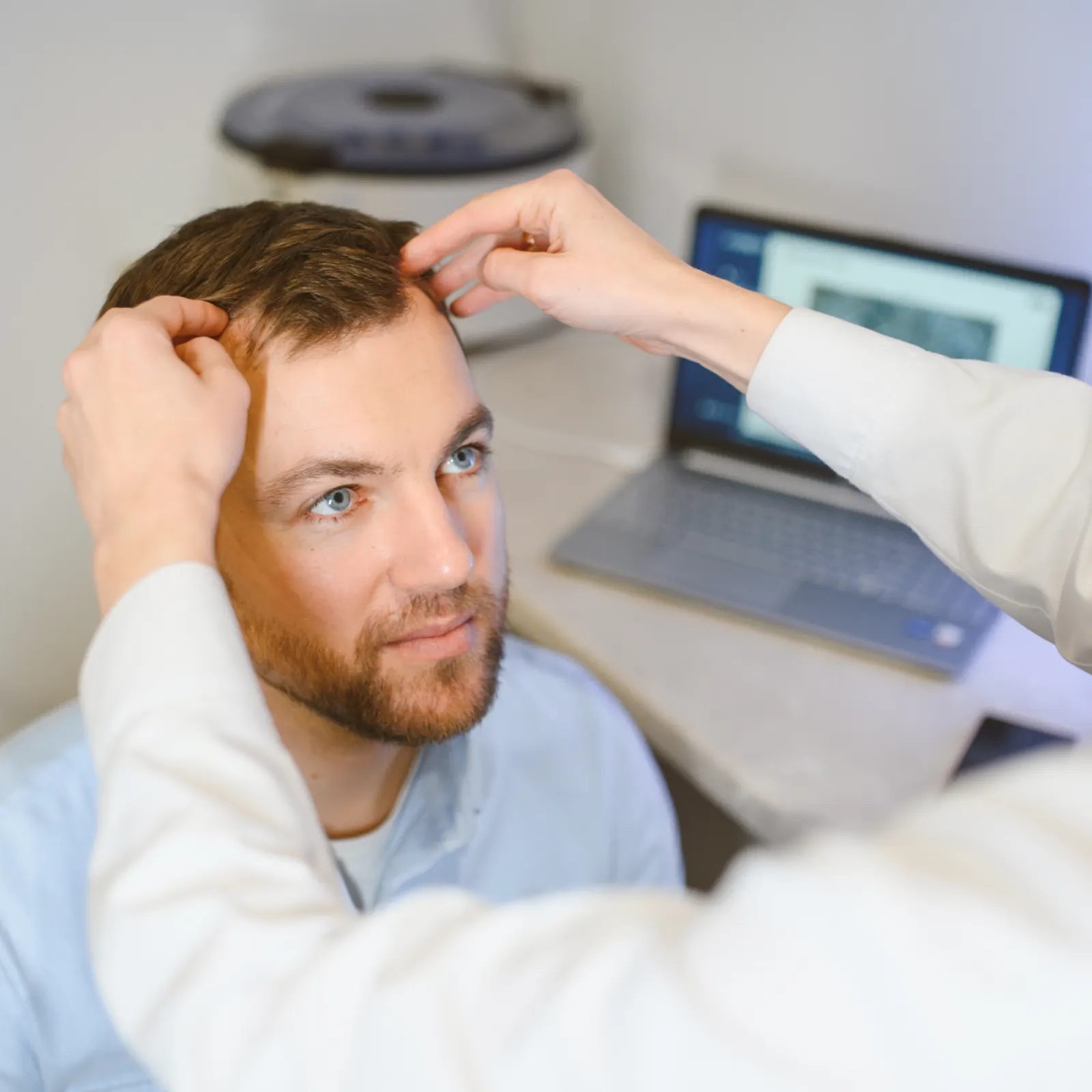 Immediately post-op after an FUE hair transplant