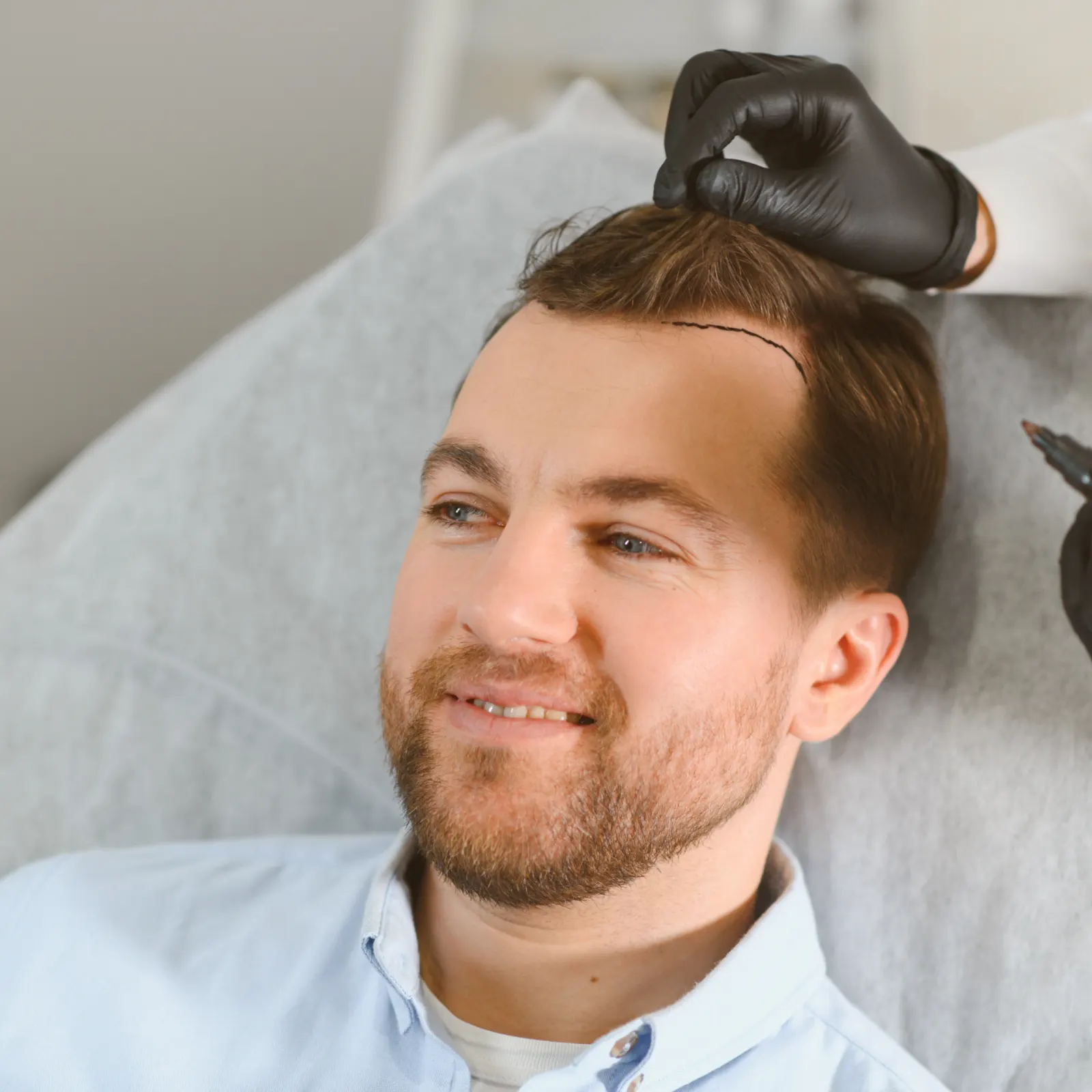 Day of the hair transplant procedure
