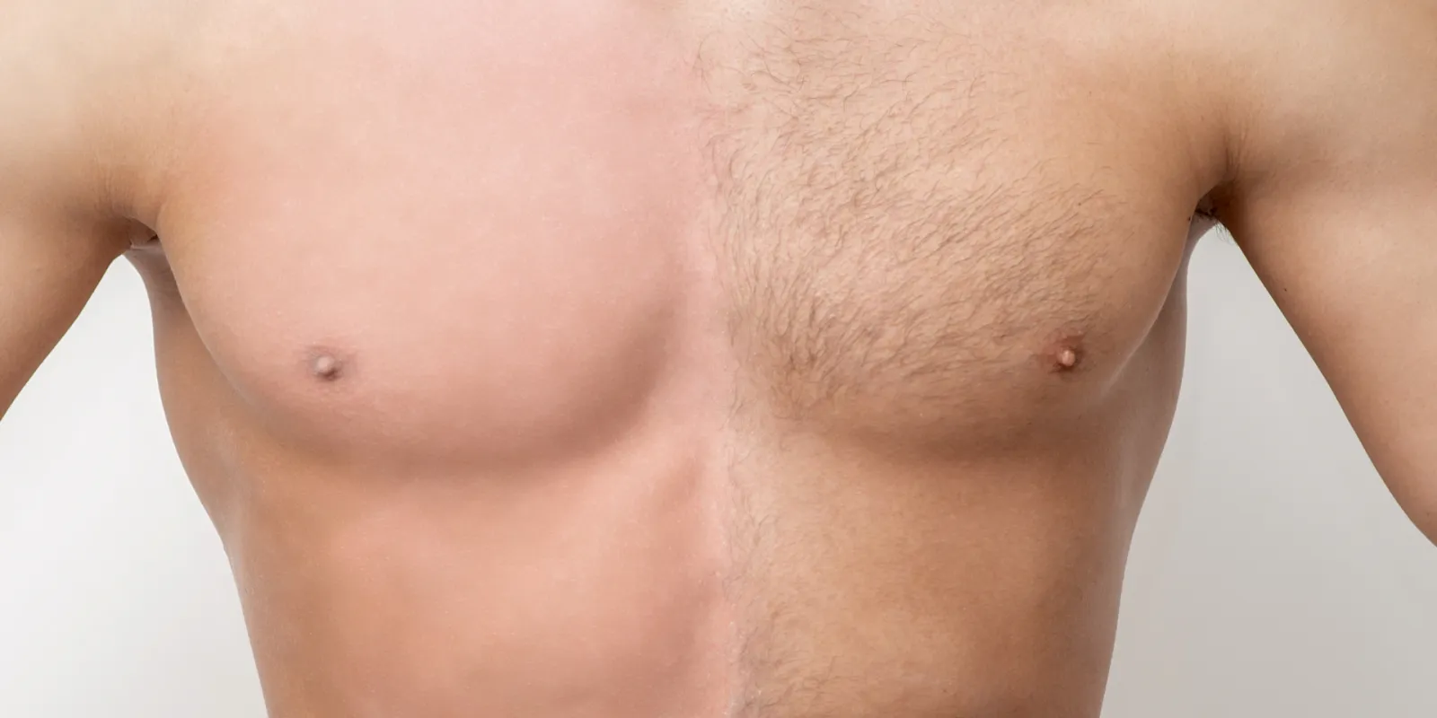 Body Hair<br>Transplant